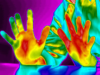 Infrared thermal image